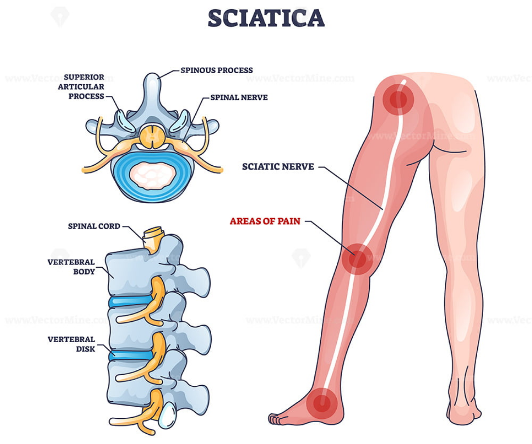 Untitled design (39)