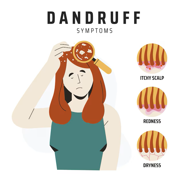 hand drawn dandruff infographic 23 2149722886