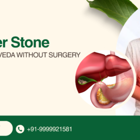 Gallbladder Stone Treatment in Ayurveda Without Surgery